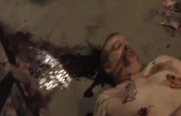 fathar fuck babe image removal of little boys dick