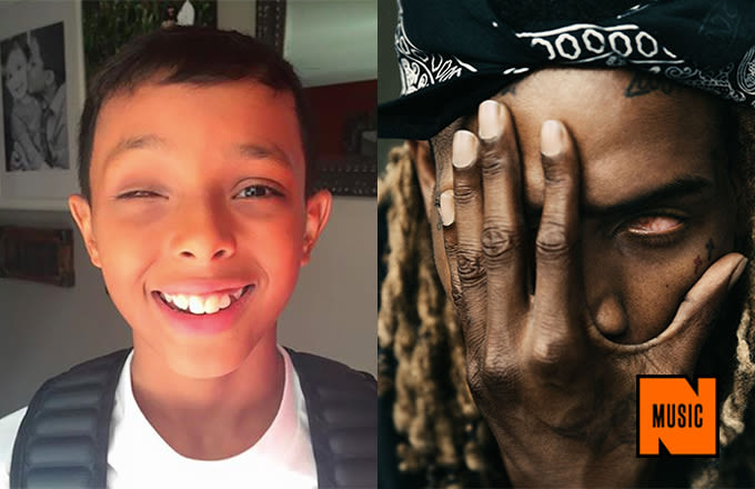 Fetty Wap Inspires a Young Kid to Stop Wearing a Prosthetic Eye