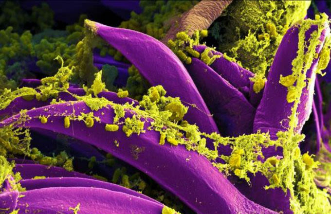 Flea Infects Oregon Teen With Bubonic Plague