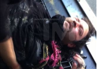 Bam Margera Got Knocked Out in a Fight
