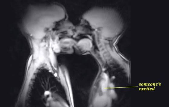 Video Shows Sex Inside An Mri Scan Complex