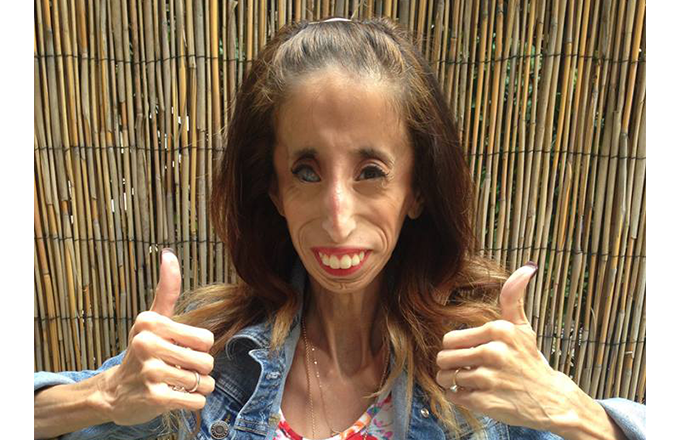 The Inspirational Story Of Mexican American Lizzie Velasquez Complex