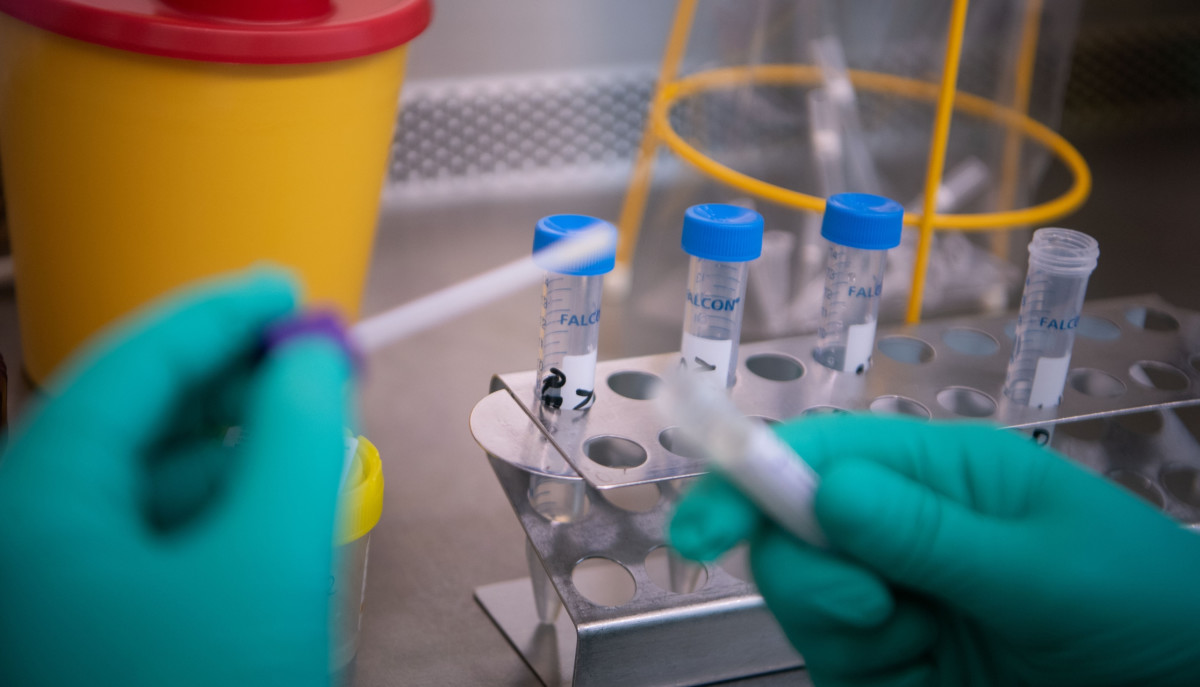 China Using Anal Swab COVID 19 Tests To Detect High Risk Cases Complex