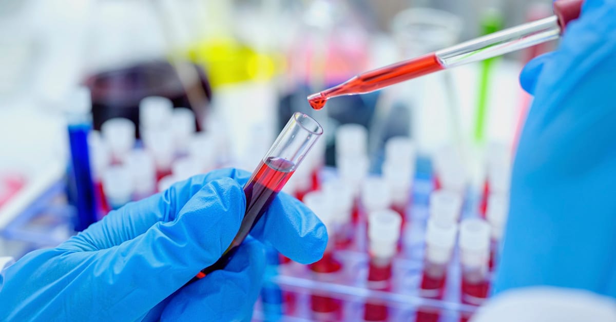 Researchers Say 66-Year-Old Man Cured of HIV After Stem Cell Transplant
