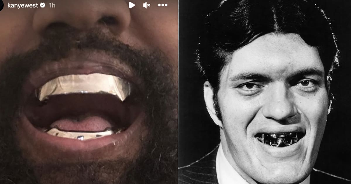 No, Kanye Didn't Get His Teeth Removed to Install $850,000 James Bond ...