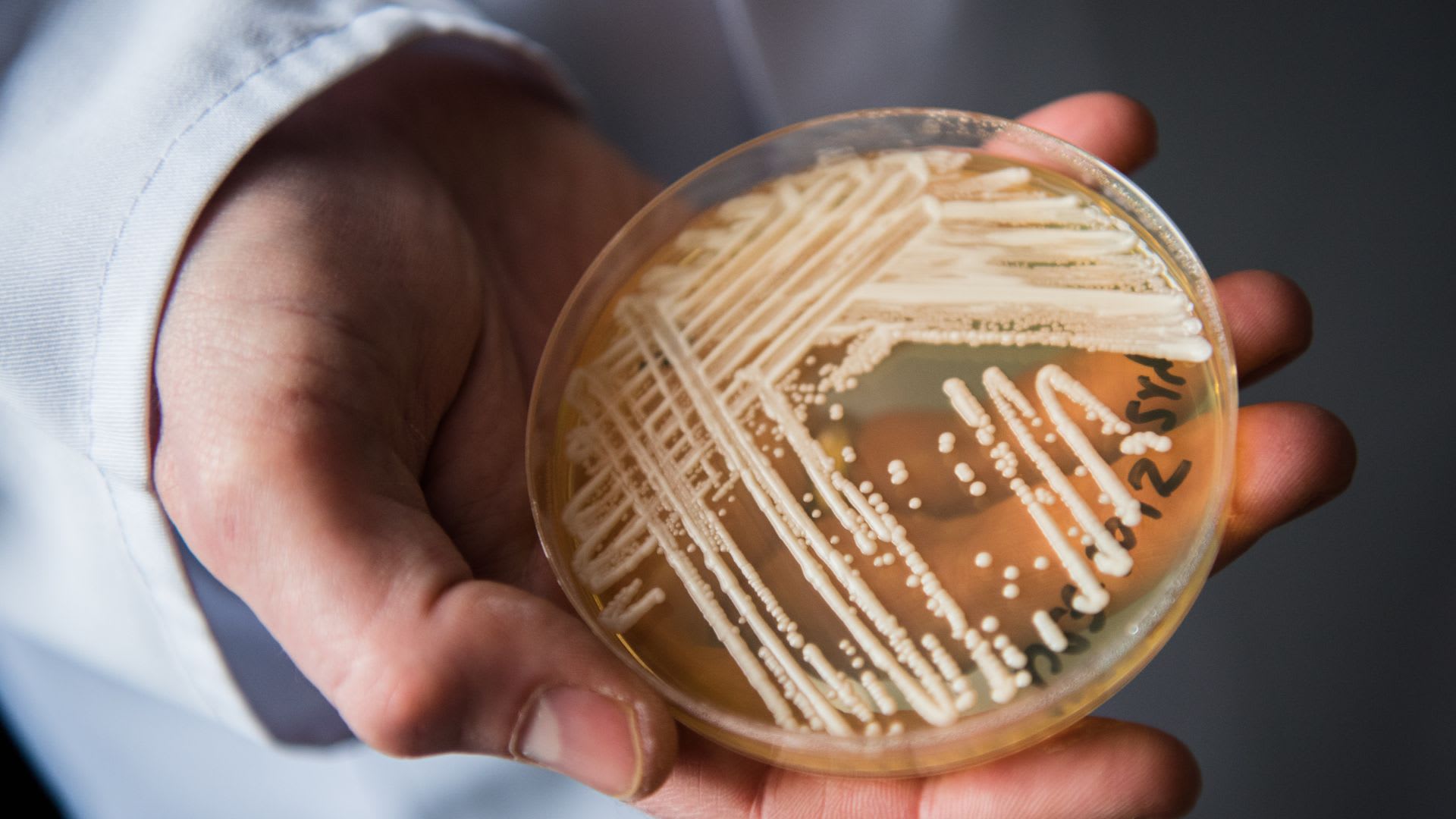 Deadly Candida Auris ‘Superbug’ Reported in 23 States So Far This Year