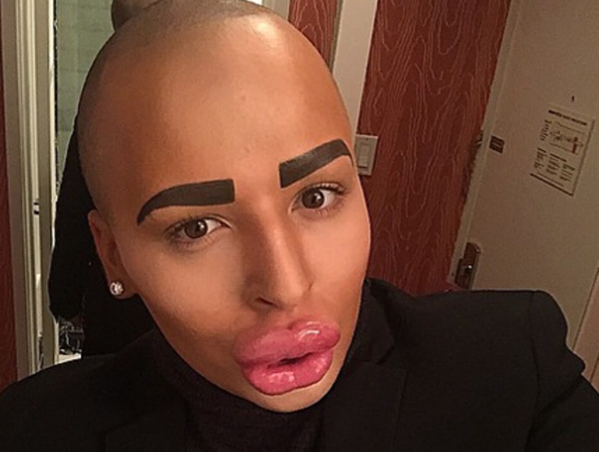 British Man Drops $150K on Plastic Surgery to Look Like Kim Kardashian