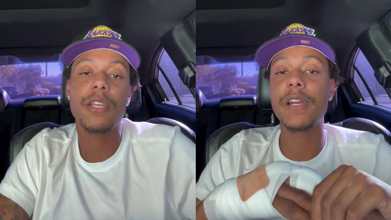 Skilla Baby in a car wearing a Lakers cap and white shirt, showing a bandaged hand.