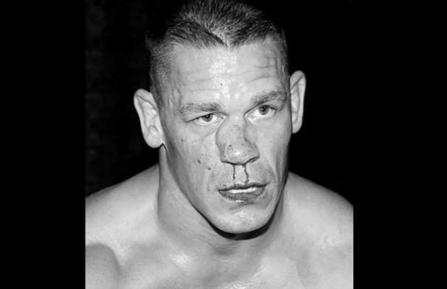 Why Blood Needs To Make A Comeback In The WWE Complex