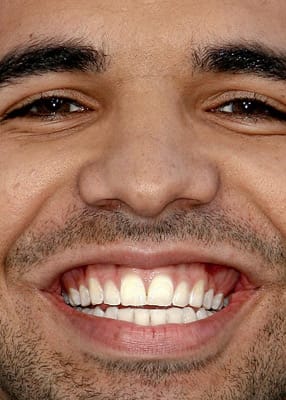 Drake - Floss Daily: 25 Rappers With Great Teeth | Complex