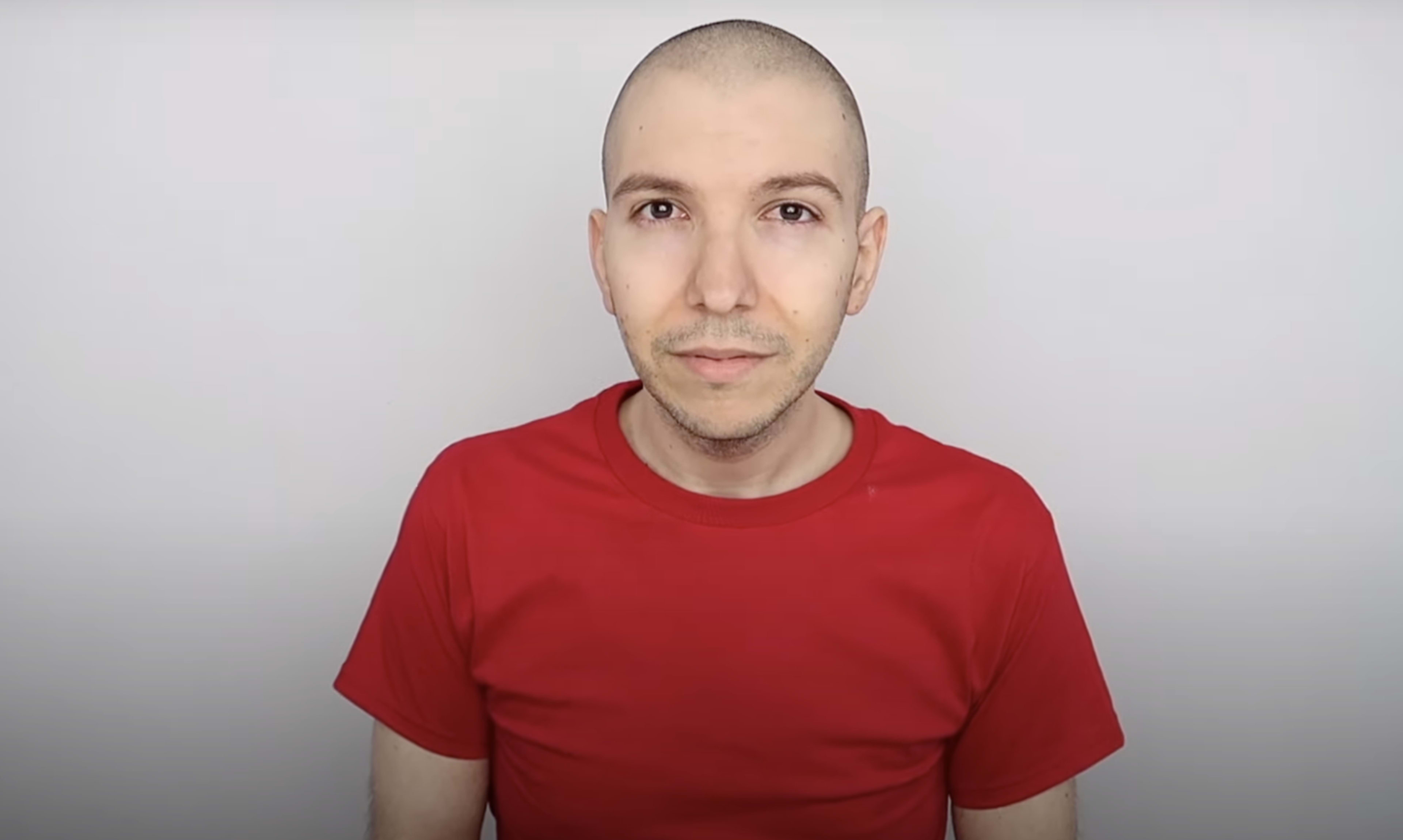 YouTuber Nikocado Avocado Loses 250 Pounds, Reveals TwoYearLong