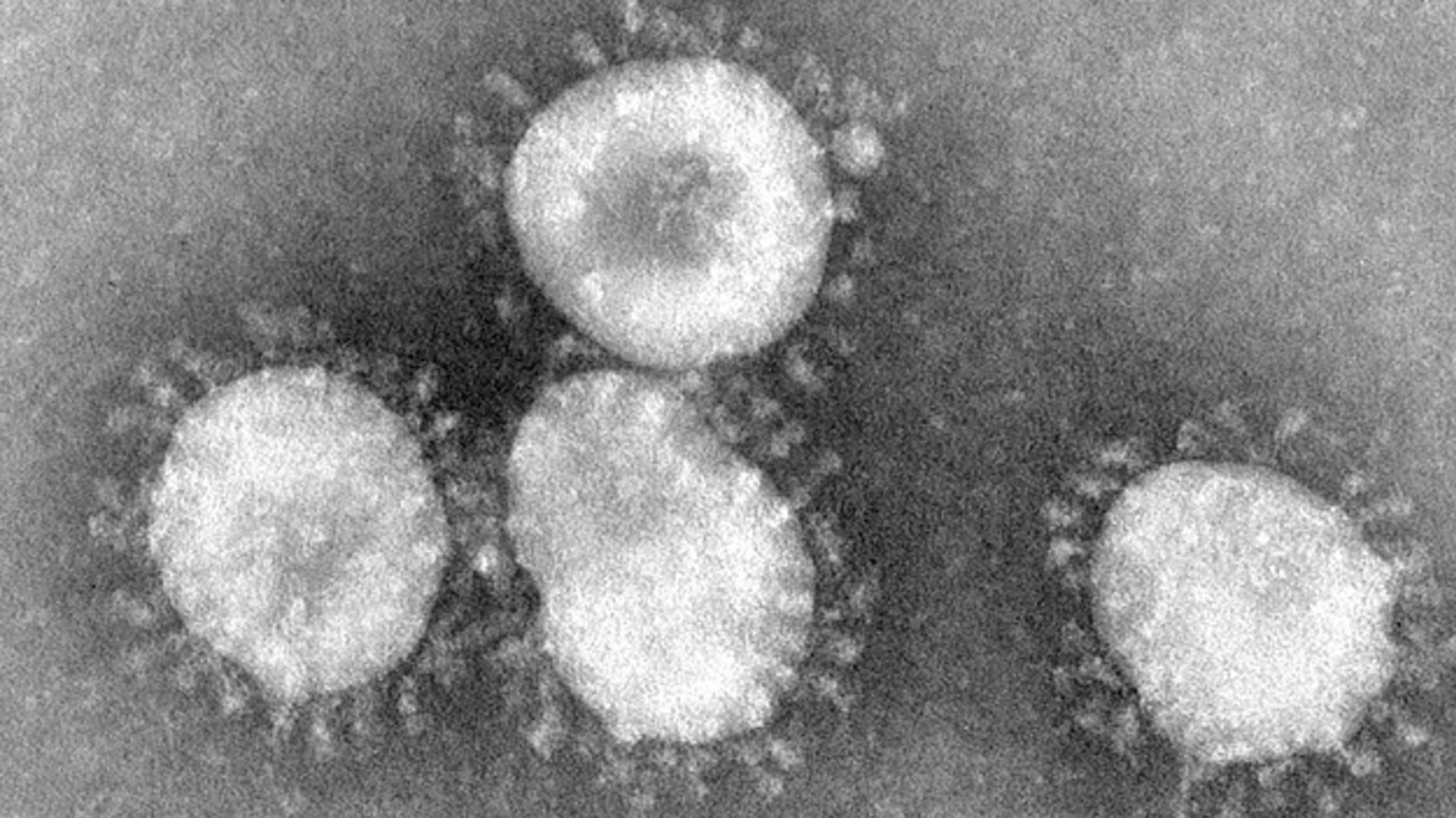 An image of coronavirus when viewed under a microscope.