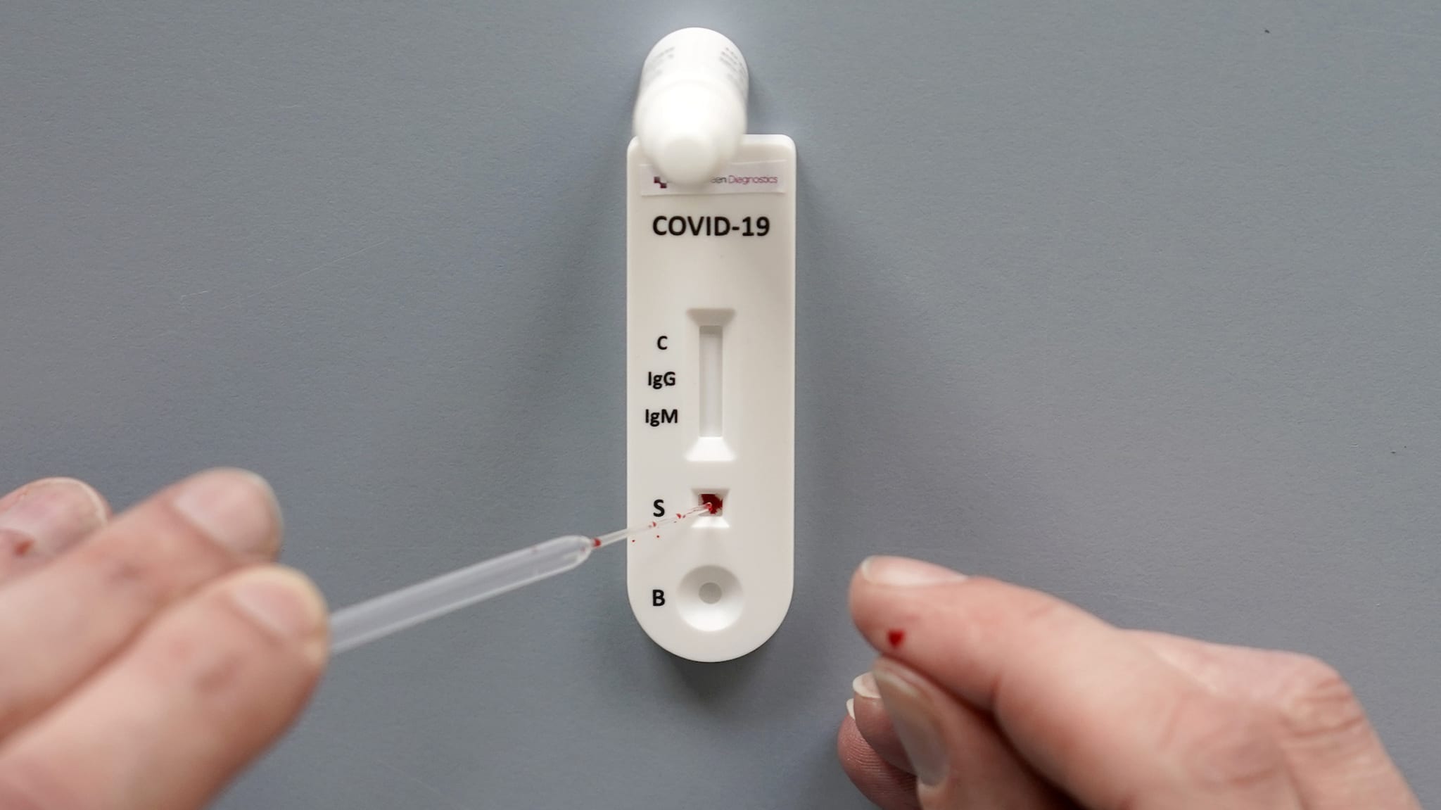 A worker demonstrates the use of a Coronavirus, Covid 19, 10 minute blood test.