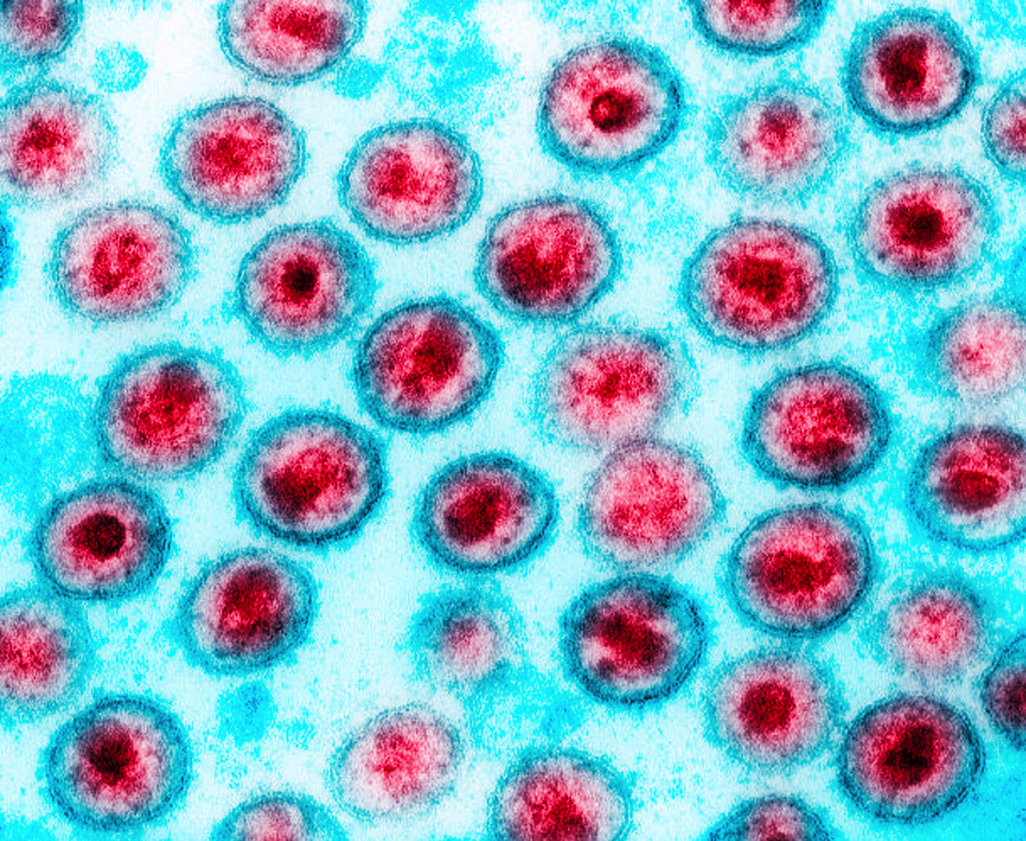 virus