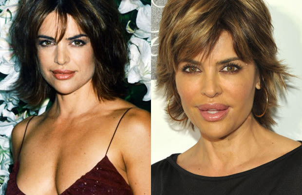 Lisa Rinna - 10 Hot Celebrities Who Destroyed Their Looks With Plastic ...