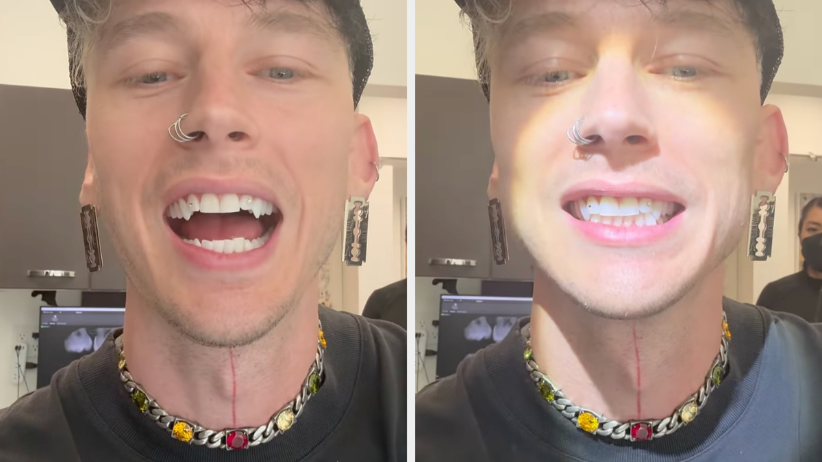 Machine Gun Kelly shows off his teeth in a close-up, wearing a cap and a beaded necklace