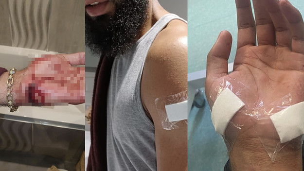 Callum Lother (credit: Instagram / Callum Lother / Metro)