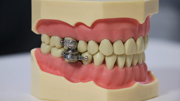 teeth