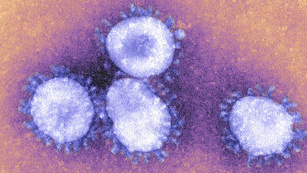 The Coronaviruses Owe Their Name To The The Crown Like Projections, Visible Under Microscope.