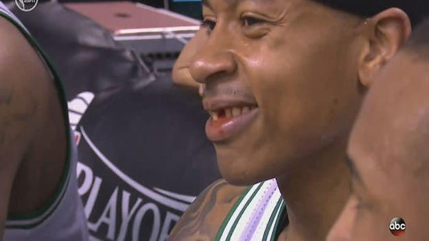 isaiah thomas lost a tooth