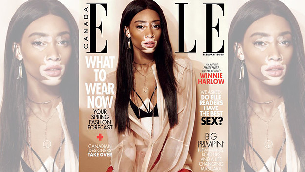 Winnie Harlow Lands Her First Cover With Elle Canada
