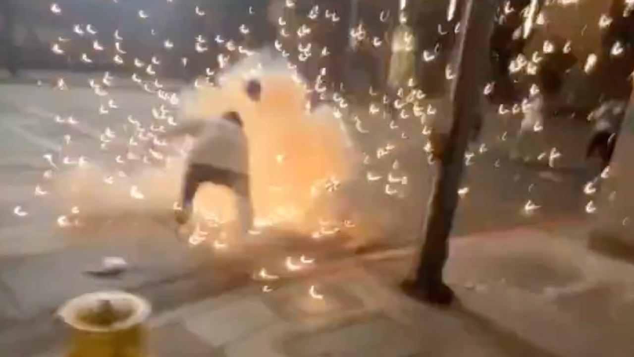 A dodgers fan in a firework accident.