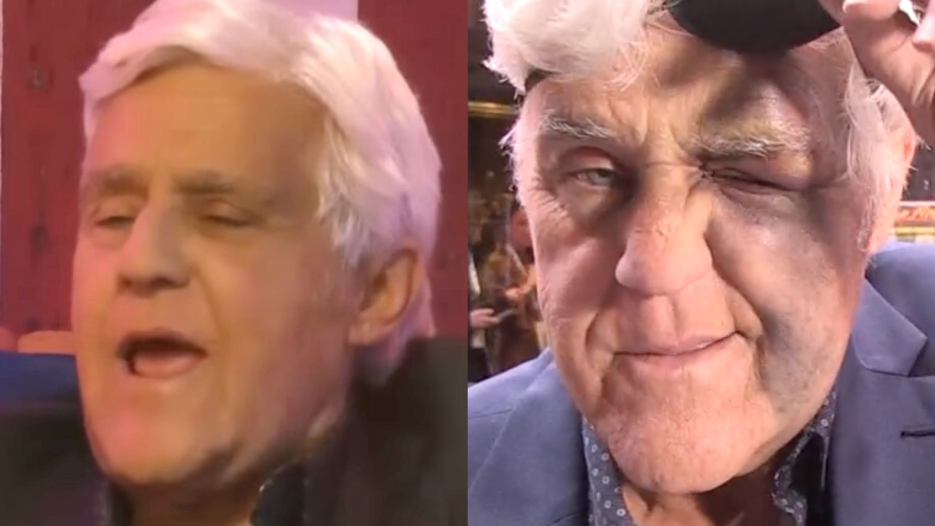 Two images of Jay Leno with white hair. In the right image, he has a bruised face and is winking.