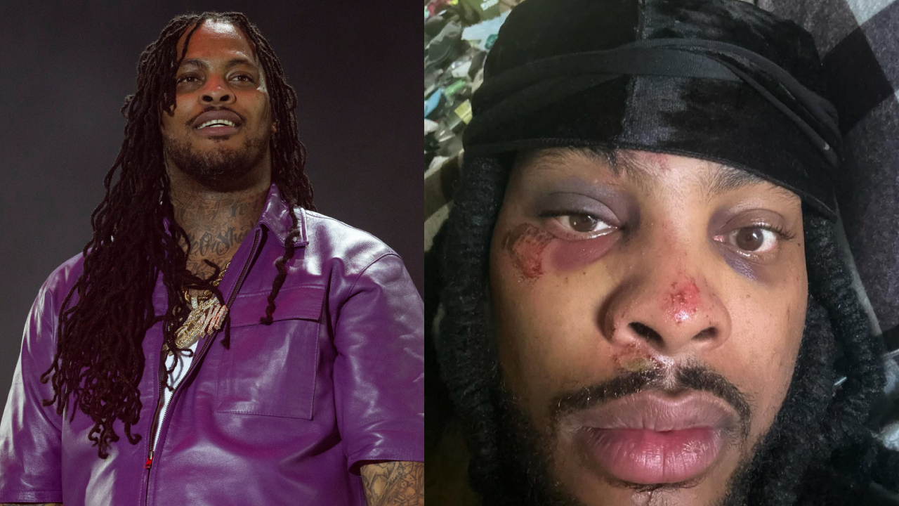 Two images of Waka Flocka Flame. Left: smiling in a purple shirt. Right: close-up with facial injuries, wearing a head wrap.