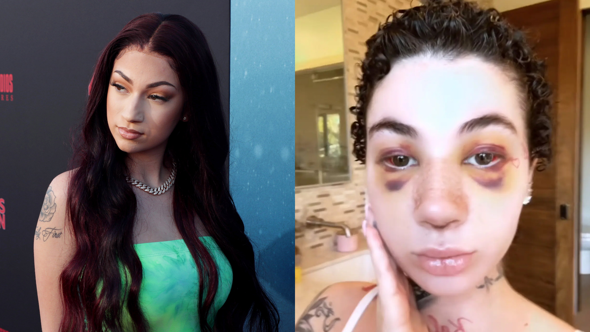 Bhad Bhabie at a movie premiere, Bhad Bhabie showing off the swelling after she got a nose job.