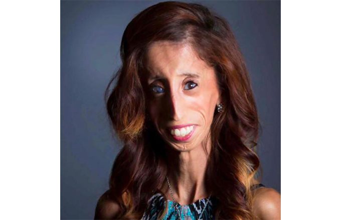 The Inspirational Story Of Mexican-american Lizzie Velasquez 