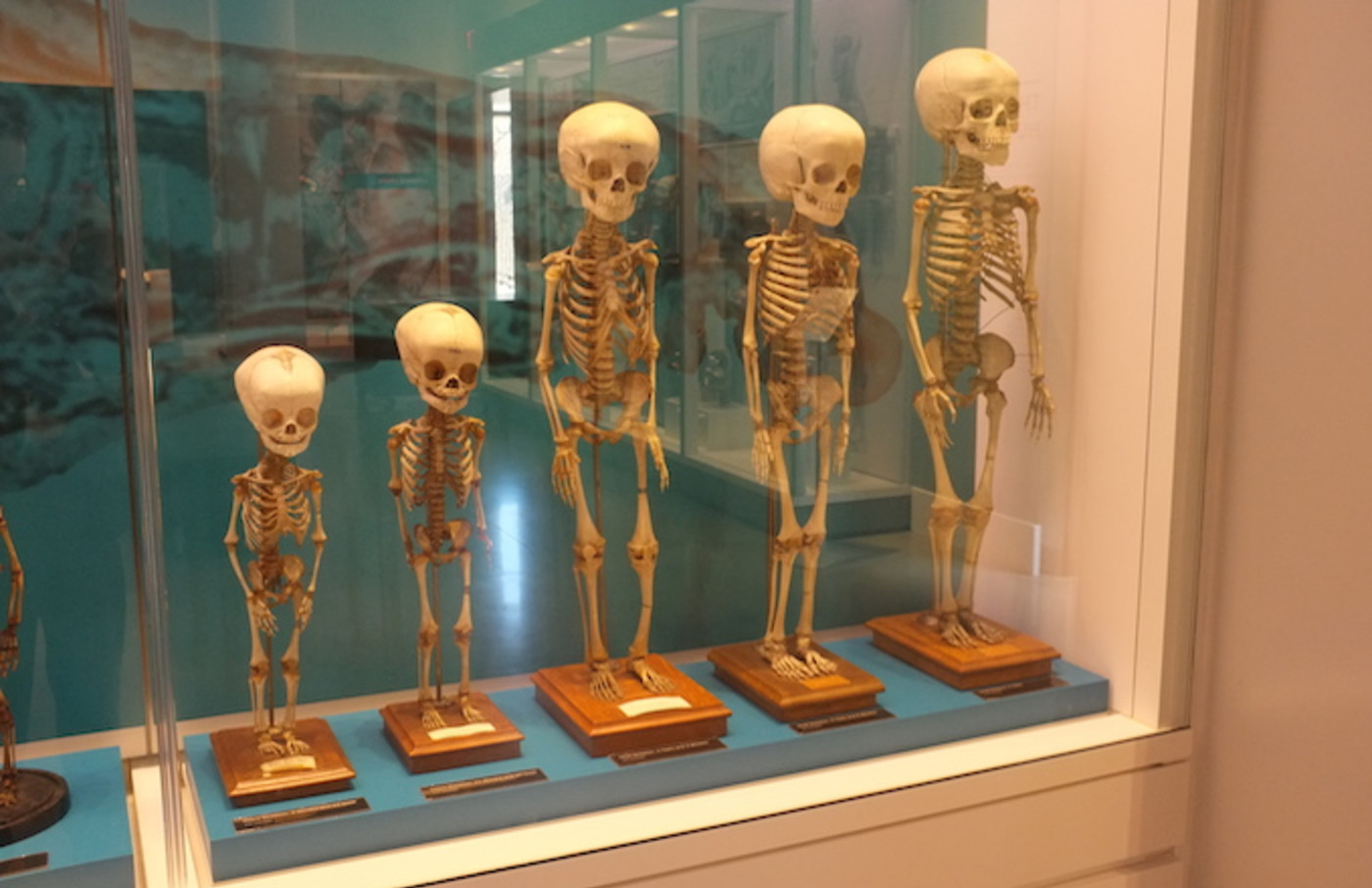 unearthed-skeleton-shows-how-people-in-fifth-century-tried-to-prevent-zombie-uprising-complex