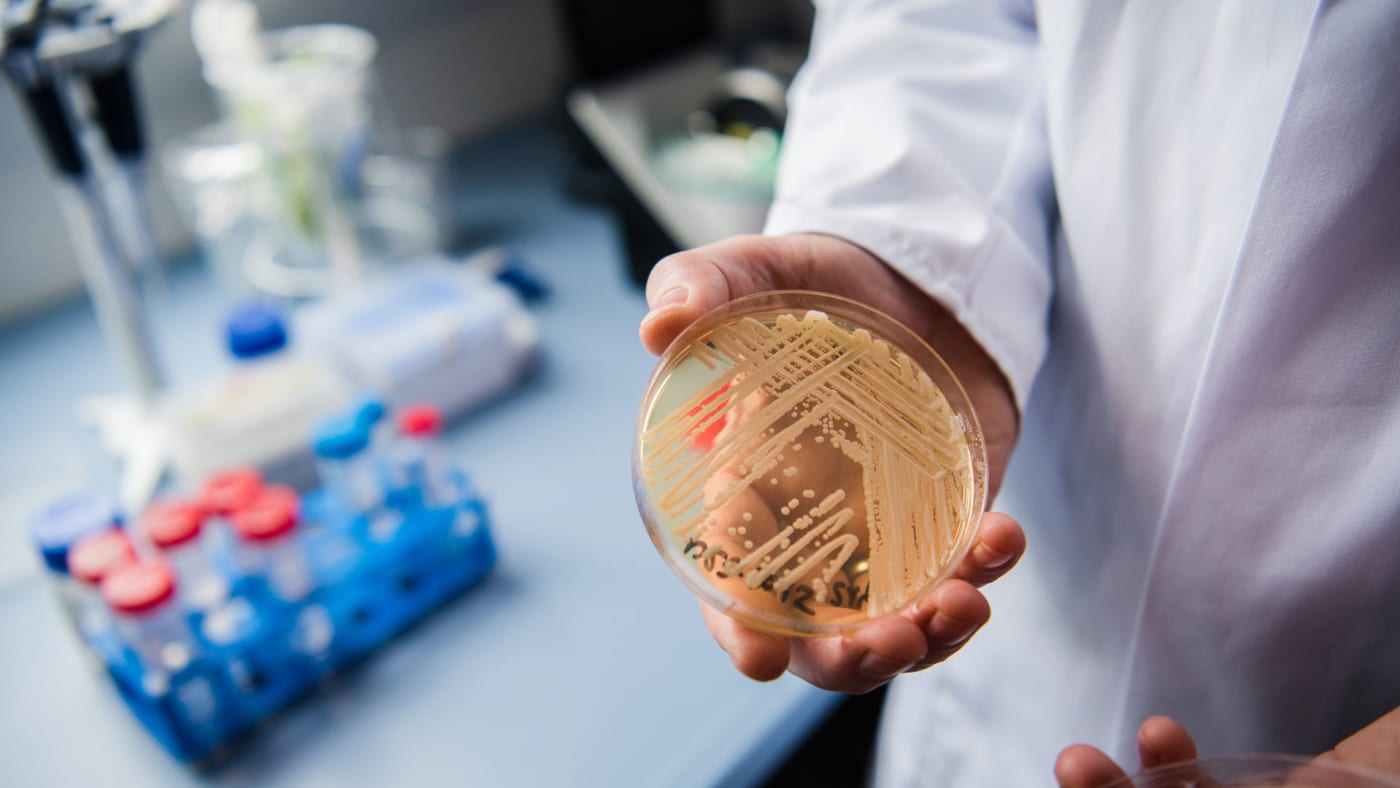 The director of the National Reference Centre for Invasive Fungus Infections holds the yeast candida auris.