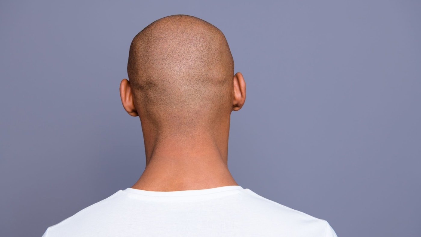 hair loss energy drinks hair loss energy drinks