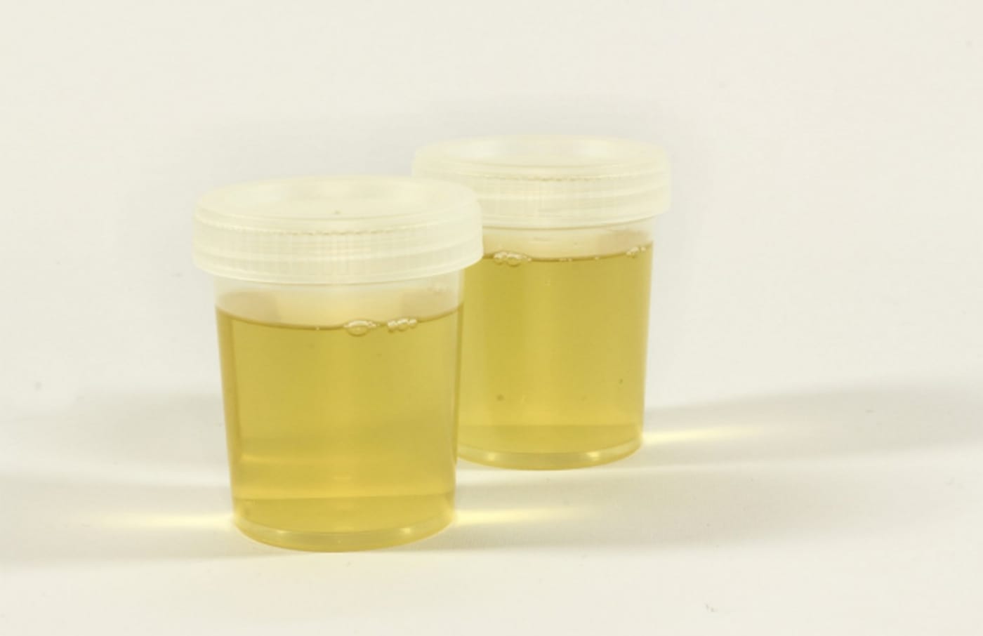 This is urine.