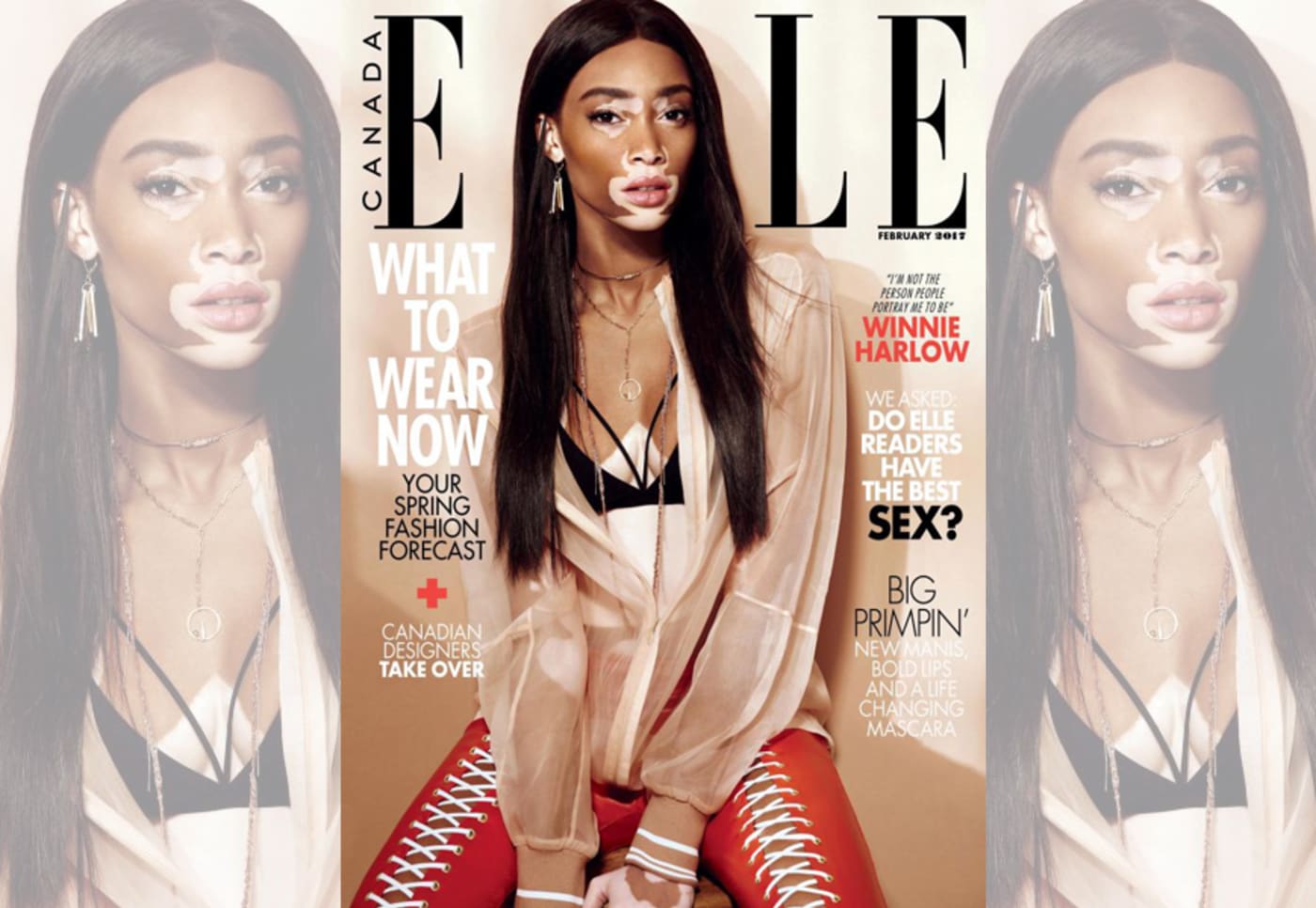 Winnie Harlow Lands Her First Cover With Elle Canada
