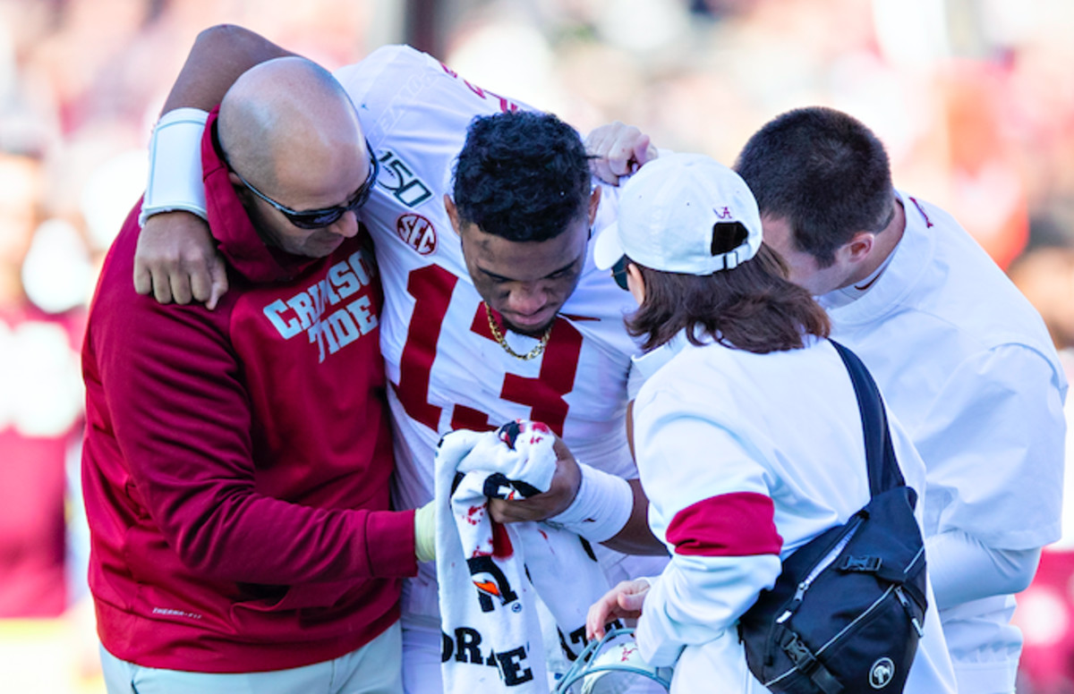 Tua Tagovailoa Reportedly Out for the Season With Hip Injury Complex